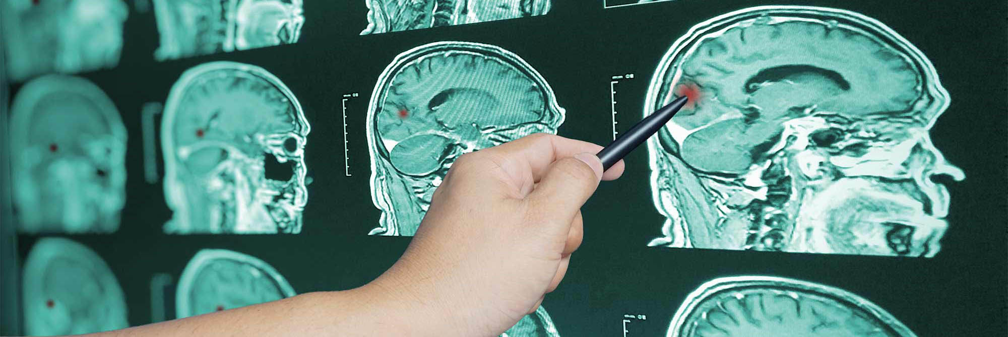 risonanza magnetica 3tesla   